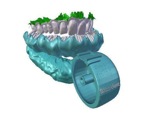 Image 1 : Une brosse à dents sur-mesure imprimée en 3D