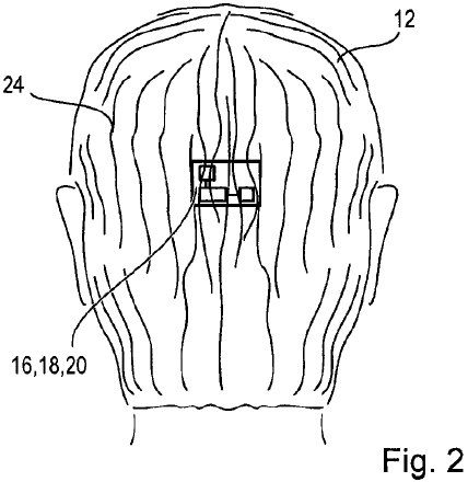 Image 3 : Sony invente la perruque intelligente
