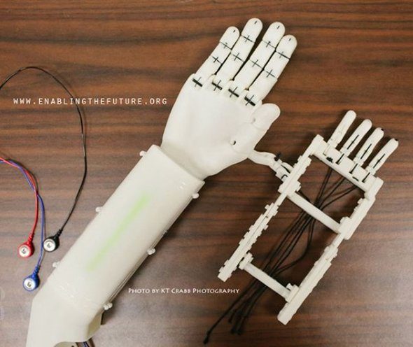 Image 4 : Un bras droit imprimé en 3D pour un garçon de 6 ans
