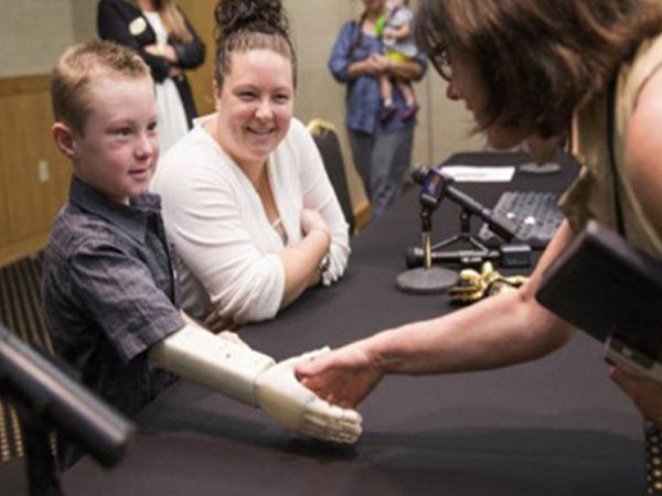 Image 1 : Un bras droit imprimé en 3D pour un garçon de 6 ans