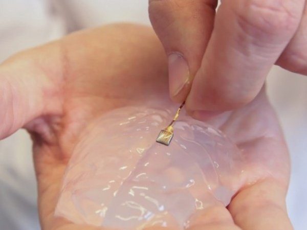 Image 1 : Un implant dans le cerveau pour lutter contre la paralysie