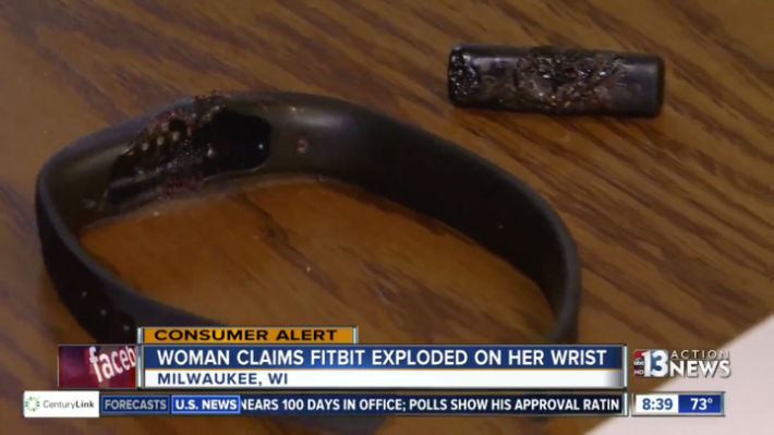 Image 2 : Une femme aurait été brûlée au second-degré par son bracelet Fitbit