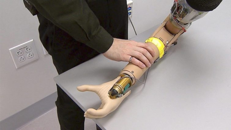 Image 1 : Un bras bionique peut maintenant détecter la présence d'un objet