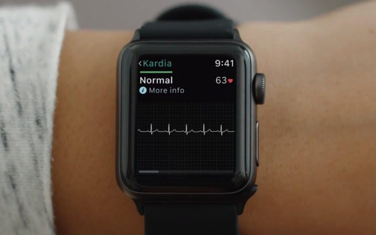 Image 1 : La bêta 3 de Watch OS 5.1 n’intègre toujours pas d’électrocardiogramme