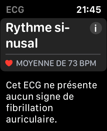 Image 33 : Montres et bracelets connectés : comment choisir ? Lequel acheter ?
