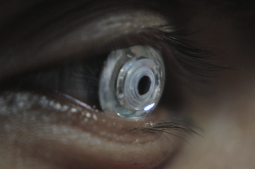 Image 1 : Voici les lentilles de contact avec zoom intégré