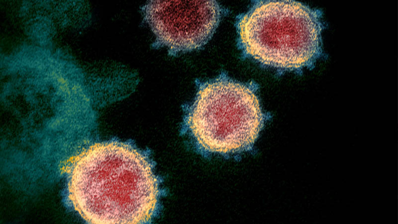 Image 1 : L’origine de la pandémie de Covid-19 est naturelle, expliquent les scientifiques
