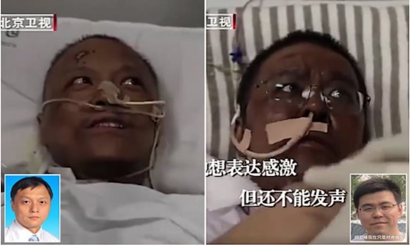 Image 2 : Covid-19 : en Chine, un traitement contre le virus rend la peau noire
