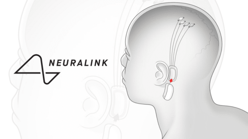 neuralink