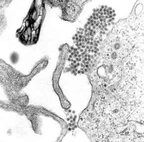 Image 8 : Grippe, Covid-19, Variole..., les virus les plus mortels de l’Histoire