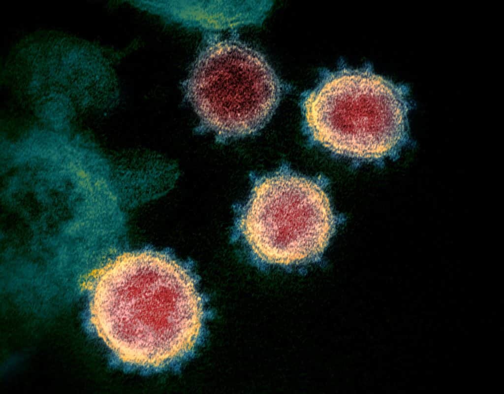 Image 9 : Grippe, Covid-19, Variole..., les virus les plus mortels de l’Histoire