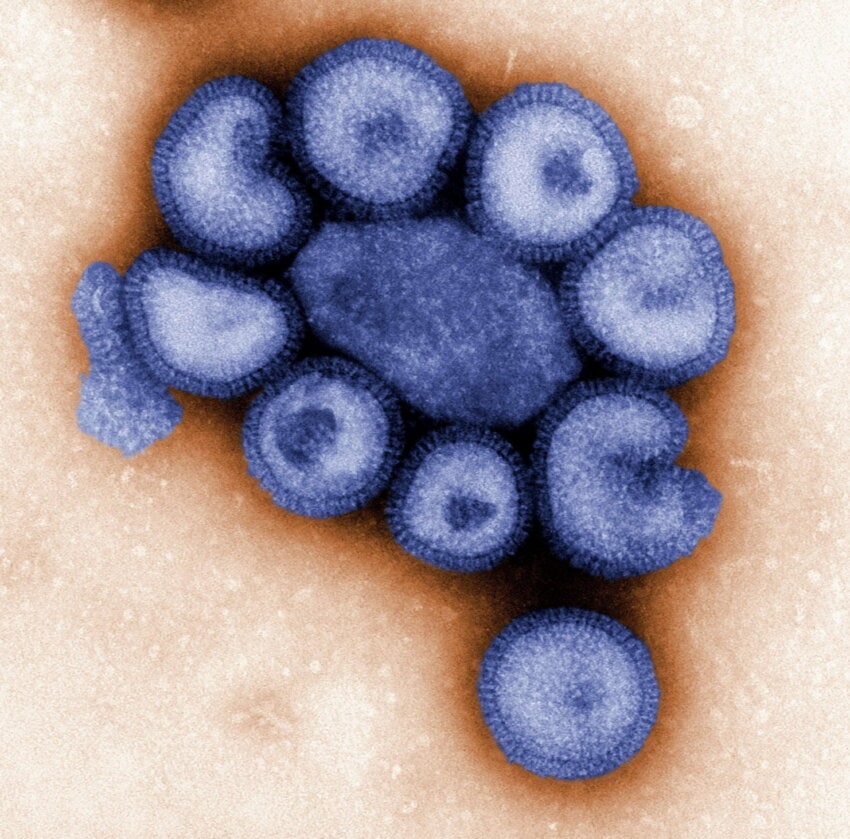Image 7 : Grippe, Covid-19, Variole..., les virus les plus mortels de l’Histoire