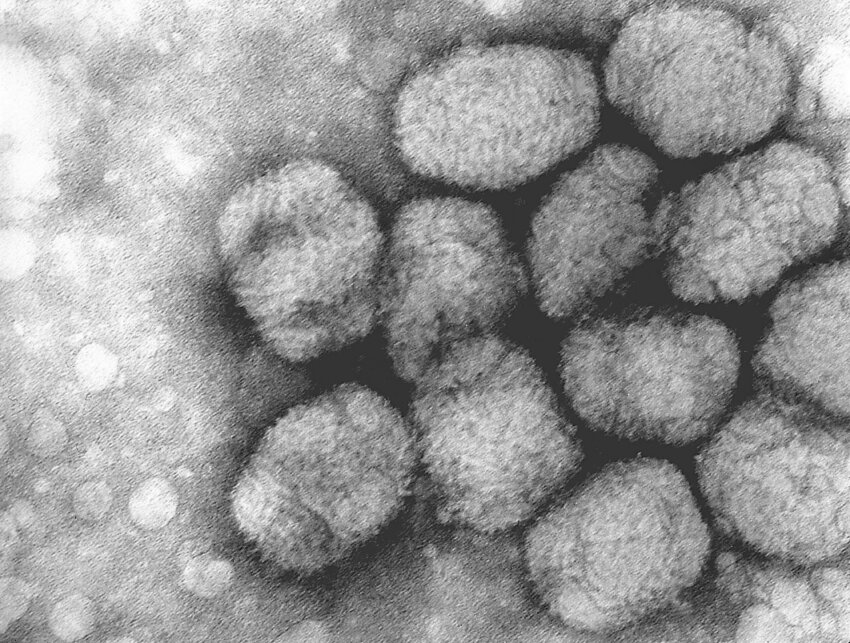Image 5 : Grippe, Covid-19, Variole..., les virus les plus mortels de l’Histoire